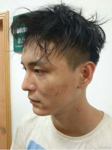 ​人气主播狗哥直播夜跑被打，斗鱼老总实名制支持狗哥要昭雪