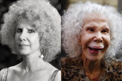 ​史上整容最失败最惨不忍的20位明星