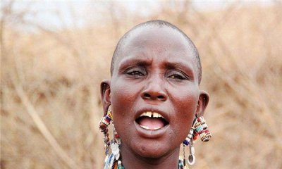 ​世界上门牙最大的人（牙齿长度达到2.28厘米，宽度达到2cm）