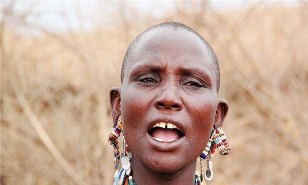 世界上门牙最大的人(牙齿长度达到2.28厘米,宽度达到2cm)(1)_