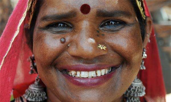 世界上门牙最大的人(牙齿长度达到2.28厘米,宽度达到2cm)(5)_