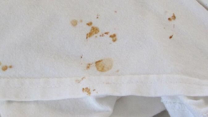 白衣服染了红色用什么能洗掉啊