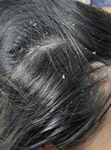 ​控油新宠来袭！油性头发用什么洗发水最好，控油洗发水排行榜