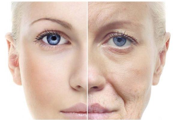 为什么会有法令纹呢 如何预防法令纹呢