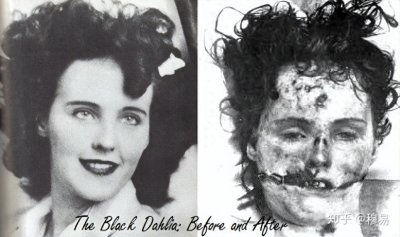 ​著名悬案黑色大丽花：现实版裂口女