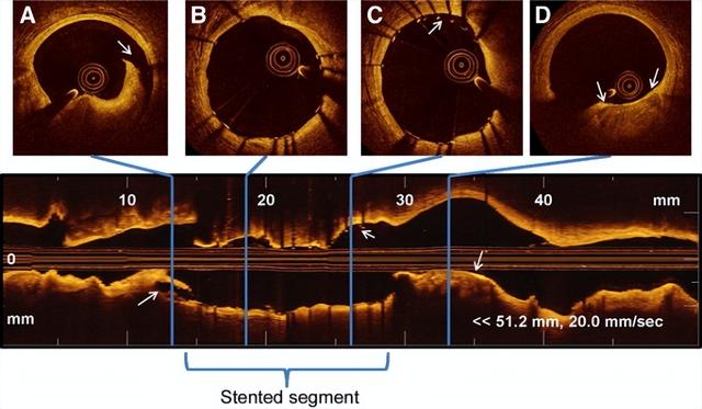 常见的单模光纤有哪些（3分钟了解保偏光纤）(27)