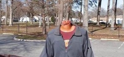 ​无头人成活15年？无头人究竟图片曝光（实在存在）